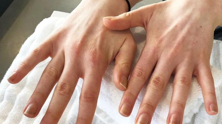 какие заболевания ногтей на руках бывают описание и фото