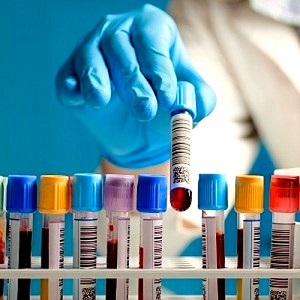 Цитологическое тестирование крови