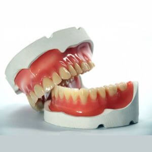 бесплатное протезирование зубов